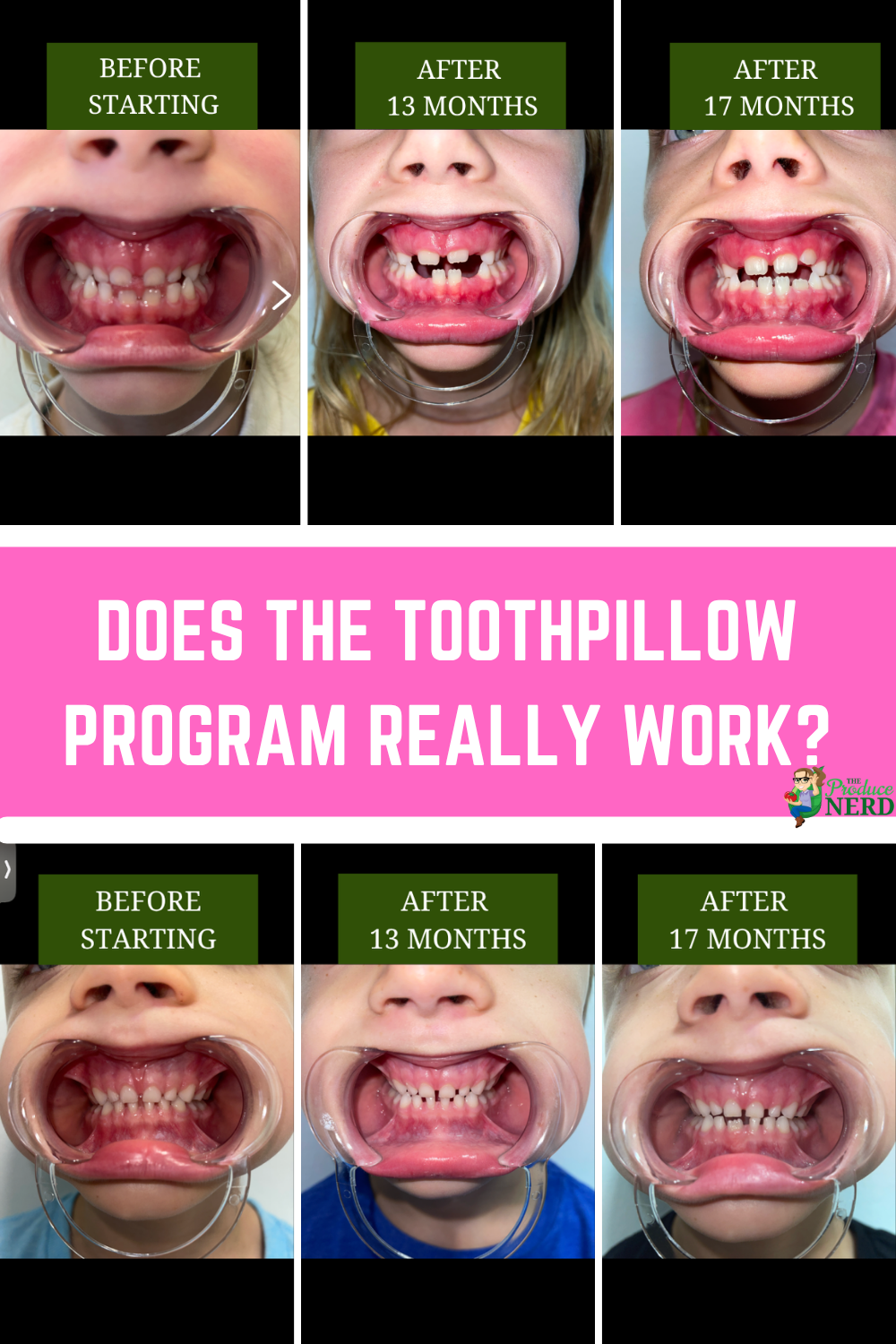 Read more about the article Honest Toothpillow Review – Is it Worth it?